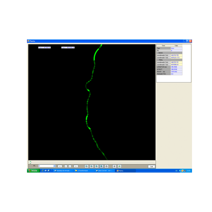 Settop Regression Axis - Image 2